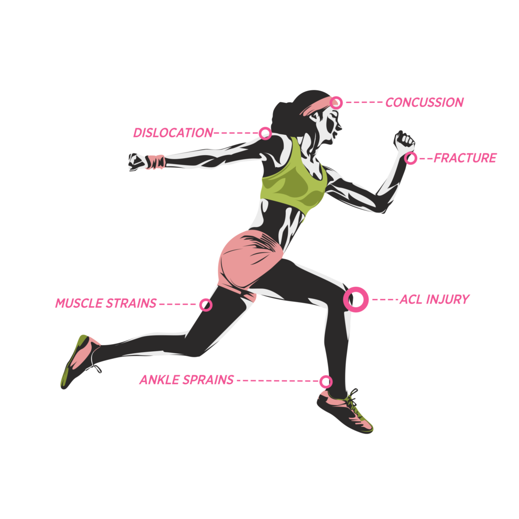 Figure 1: Common sites of injury in female athletes
